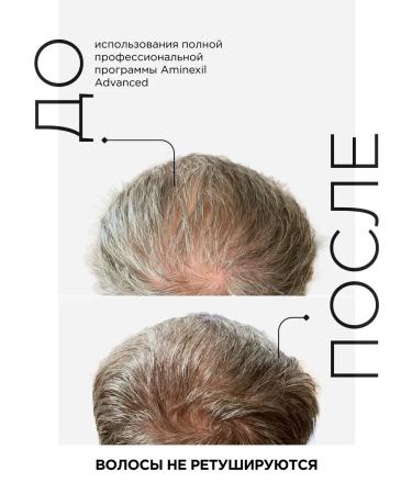 L'Oreal Professionnel Lotion-departure in monodoses from hair loss Aminexil 10 pcs - Buy Online on GoSupps.com