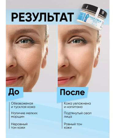 RO Moisturizing face cream - Buy Online on GoSupps.com