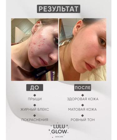 Lulu Glow Restorative whey for face - Buy Online on GoSupps.com