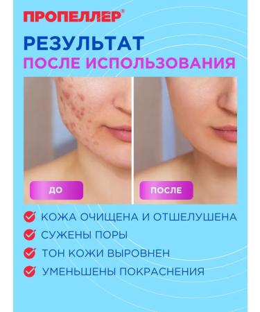 PROPELLER Salicylic facial skeleton from acne 100 ml (2 pcs) - Buy Online on GoSupps.com