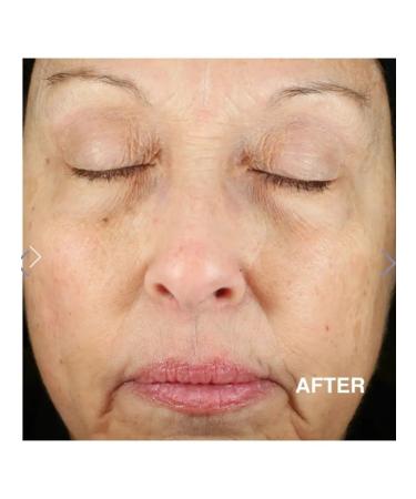 Derma E Face -face against wrinkles - Buy Online on GoSupps.com