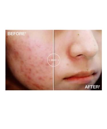 Derma E 10% multi -word lighting face peeling - Buy Online on GoSupps.com