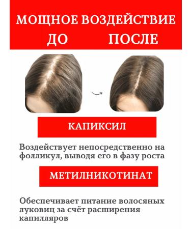 Tatyana's House Hair growth activator - Buy Online on GoSupps.com