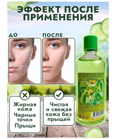 WONDERCOSM Cucumber acne lotion - Buy Online on GoSupps.com