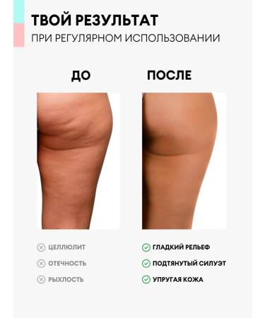 KISMIT Beauty Lopolitics of the body serum - Buy Online on GoSupps.com