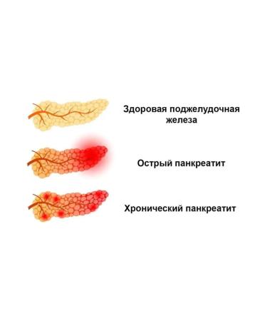 The Ural Nature Reserve The pancreas is healthy - Buy Online on GoSupps.com