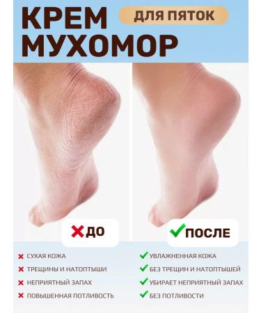 Bizoryuk Cream Myx0m0p for heels with urea - Buy Online on GoSupps.com