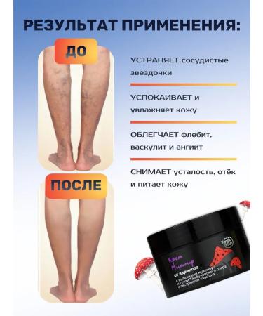 Bizoryuk Cream Myx0m0p from varicose vegetables with chestnut extract - Buy Online on GoSupps.com