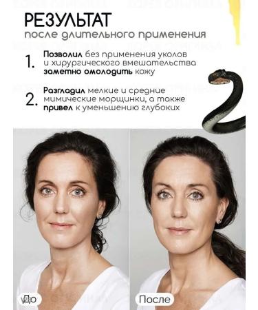 be young Korean face cream anti-aging SYN-AKE - Buy Online on GoSupps.com