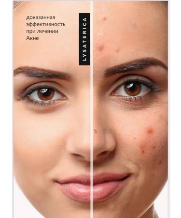 LYSATERICA Coiling serum (anti -Eiga) for skin care - Buy Online on GoSupps.com