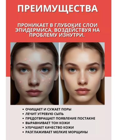 Natural Science Tretinoin Gel 0.05% of wrinkles and acne Tretinoin - Buy Online on GoSupps.com