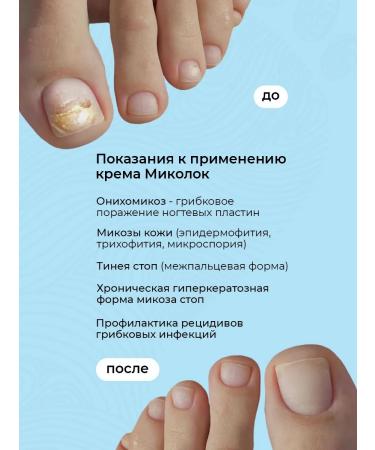 Sashera honey Cream from nail fungus on the legs of mycols - Buy Online on GoSupps.com