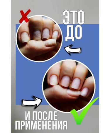 Gehwol Fluid nail care antifungal - Buy Online on GoSupps.com