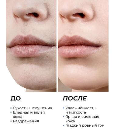 Seauty Moisturizer cream with ceramides and face tonic - Buy Online on GoSupps.com