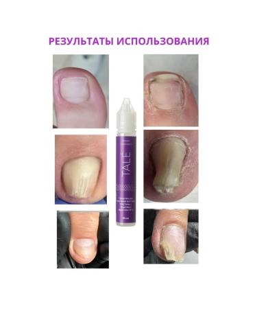 TALE Anti -inflated nail and fungus - Buy Online on GoSupps.com