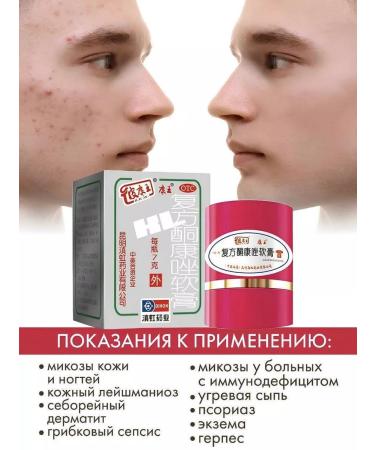 China Brands Cream King of the skin from psoriasis and acne 2 pcs - Buy Online on GoSupps.com