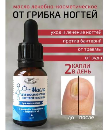 Springs of Siberia Oil from nail fungus healing stop onycholysis