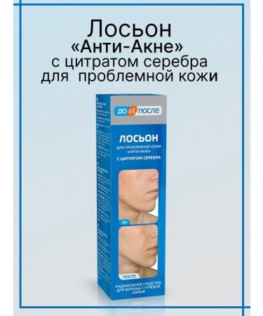 Twins Tech Acne and eeling lotion 200 ml - Buy Online on GoSupps.com