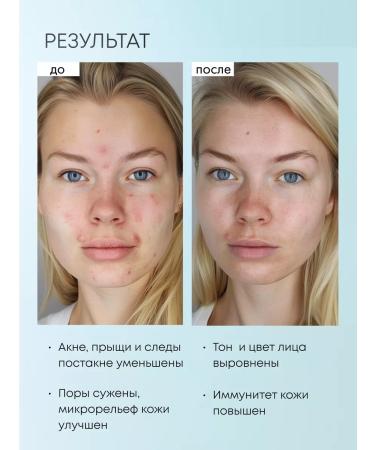 Natura Siberica Facial serum from acne and post -acne with niacinamide 30 ml - Buy Online on GoSupps.com