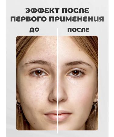 Vitex Aloe face cream moisturizer Aloe 97% 50 ml - Buy Online on GoSupps.com