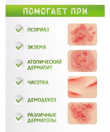 Green Ointment from psoriasis series 60ml - Buy Online on GoSupps.com