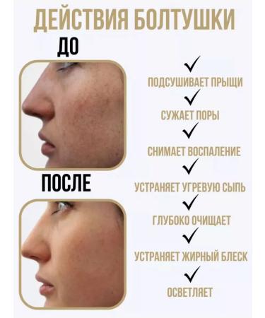 Gangster Acne chatterbox and acne for face salicylic 250 ml - Buy Online on GoSupps.com