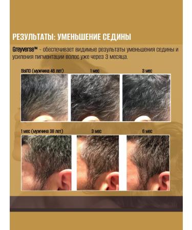 Olfactorius Manufactory SPLENDOUR hair growth activator (capsil gravex) (50g) - Buy Online on GoSupps.com