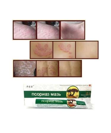 Nica Cosmetics Psoriasis ointment - healthy skin - Buy Online on GoSupps.com