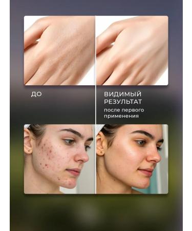 Limits Moisturizing hand cream and peeling foam - Buy Online on GoSupps.com