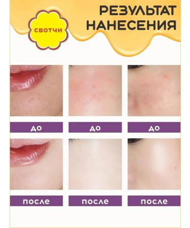 Chupa Chups Smooth block for the tonal base-rush 4.0 medium - Buy Online on GoSupps.com