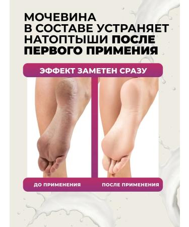 Horsepower Feet and heels with urea 30% of cracks and corns - Buy Online on GoSupps.com