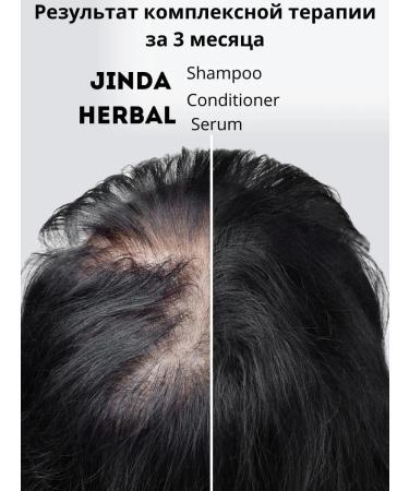 COSMEDJI Jinda shampoo and air conditioner for hair growth - Buy Online on GoSupps.com