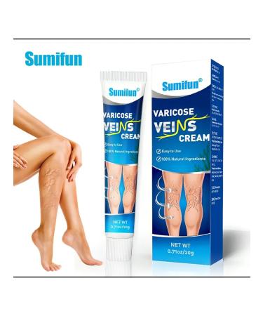 INDIAN BAZAAR Chinese cream against varicose veins severity of the legs and infections