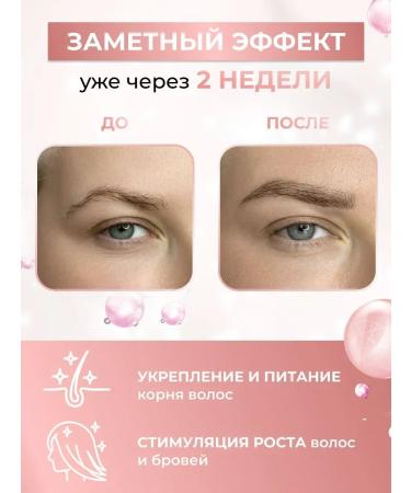 Healing Uzma seed oil for eyebrow and hair growth - Buy Online on GoSupps.com