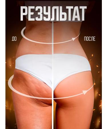 JOHN GOLD Fat -burning losing weight anti -cellulite from stretch marks - Buy Online on GoSupps.com