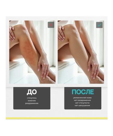 Mivlane Slowing hair growth after depilation 200 ml - Buy Online on GoSupps.com