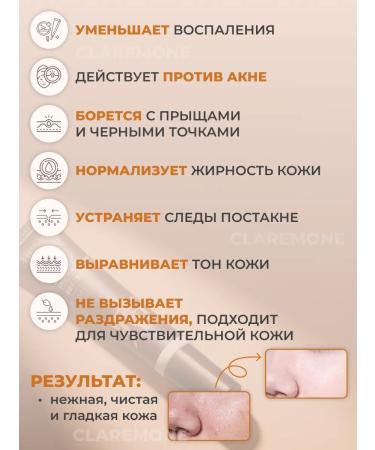 CLAREMONE Acne cream and acne - Buy Online on GoSupps.com