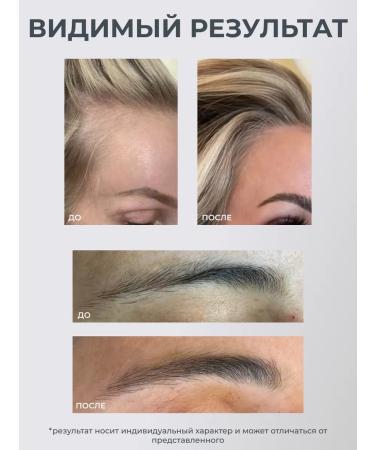 Mesonica Mesoroller Facial massage Set - Buy Online on GoSupps.com