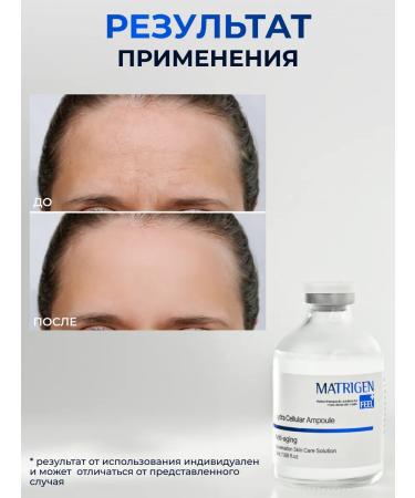 Matrigen Anti -aging serum anticipated 50 ml - Buy Online on GoSupps.com