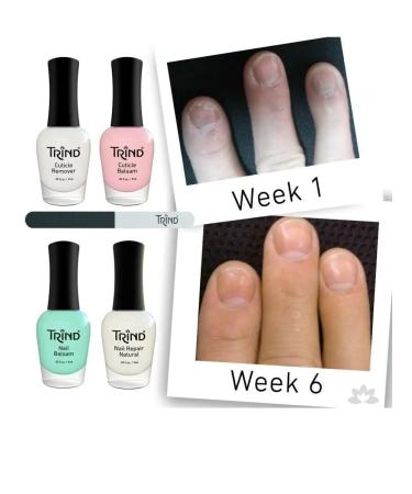 Trind Keratin Nail Protector Ceratin Failure Protection - Buy Online on GoSupps.com