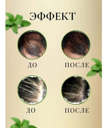 MEIDU Therapeutic shampoo against falling out. Professional - Buy Online on GoSupps.com