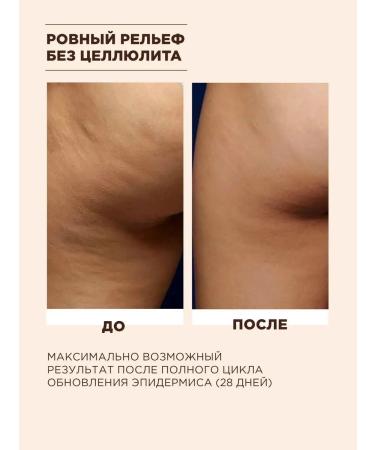 MIXIT Anti -cellulite coffee beams for body oils - Buy Online on GoSupps.com