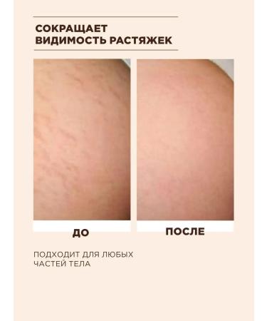 MIXIT Anti -cellulite coffee beams for body oils - Buy Online on GoSupps.com