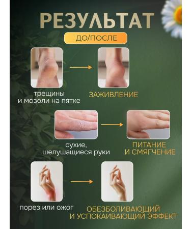 Raifa Monastery Healing ointment of Zhivitsa with flies 50 ml - Buy Online on GoSupps.com