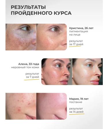 Lefami Serum from age spots whitening for the face and body - Buy Online on GoSupps.com