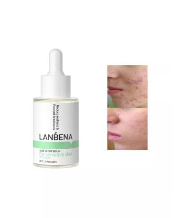 LANBENA From acne whey for sensitive skin 30 ml - Buy Online on GoSupps.com