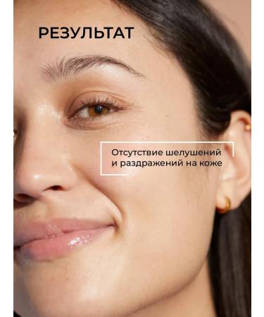 REVOLUTION SKINCARE Moisturizing face cream Ceramides Moisture Cream - Buy Online on GoSupps.com