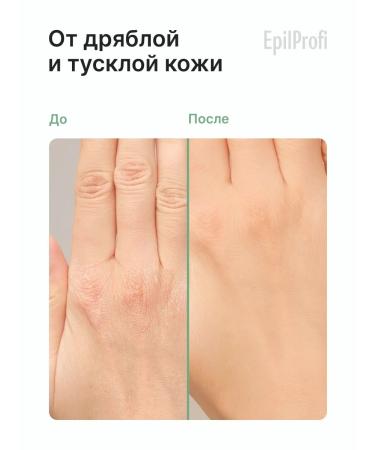 EpilProfi Hand cream with moisturizing care and nutrition - Buy Online on GoSupps.com