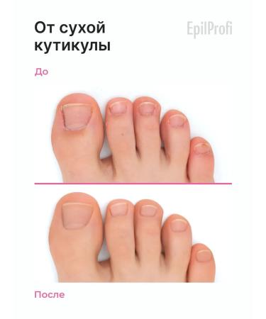 EpilProfi Remover for cuticle pedicure urea for the legs 250ml - Buy Online on GoSupps.com