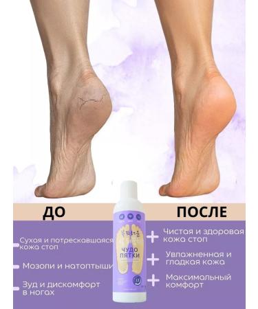 COSMEDJI Liquid blade for smooth heels gel and pumice in the set - Buy Online on GoSupps.com
